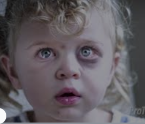 child abuse 2