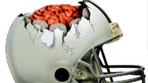 concussion helmet